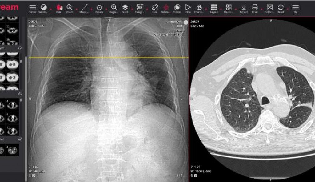 Dicom web viewer. Dicom. Dicom viewer. Vidar Dicom viewer. Dicom просмотр.